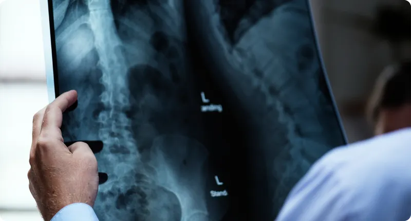 Profesional observa una radiografía de tórax en un visor de diagnóstico.